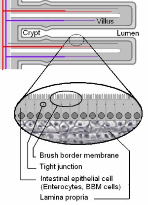 Celiac Disease Biopsy and Villi