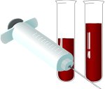 Celiac Disease Blood Test